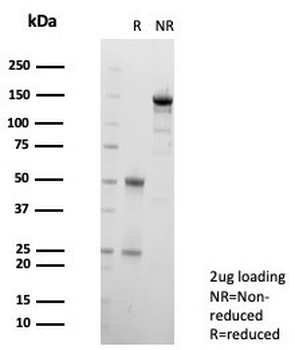 Galectin-3 Antibody / LGALS3