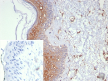 Galectin-3 Antibody / LGALS3