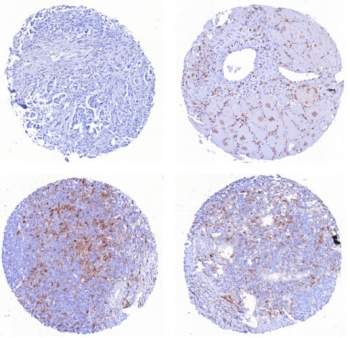 CD162 Antibody / PSGL-1