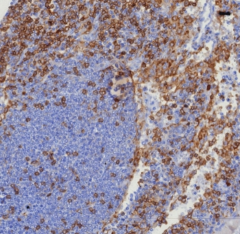 Recombinant CD4 Antibody