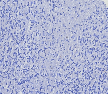 Recombinant CD4 Antibody