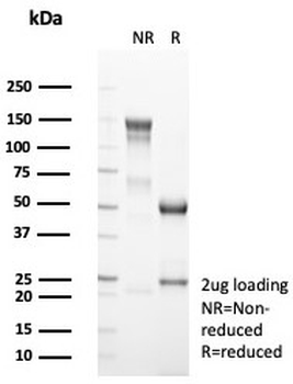 Recombinant CD4 Antibody