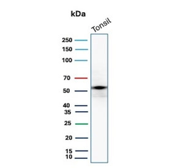 Recombinant CD4 Antibody