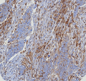 Recombinant CD4 Antibody