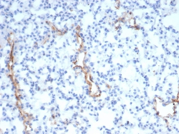 von Willebrand Factor Antibody