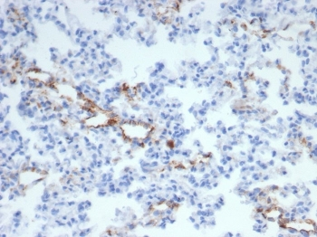 von Willebrand Factor Antibody