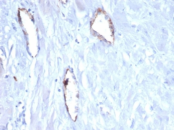 von Willebrand Factor Antibody