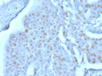 Y-box-binding protein 3 Antibody / YBX3