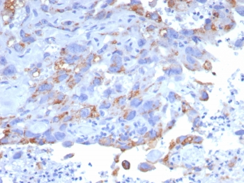 PEIG-1 Antibody / RAI3 / GPRC5A