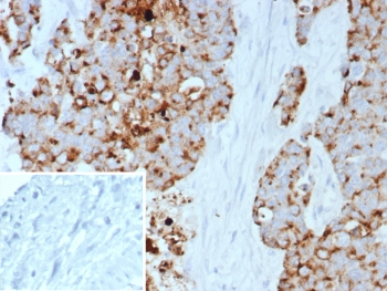 PEIG-1 Antibody / RAI3 / GPRC5A