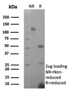 CD163 Antibody