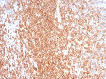 Recombinant CD27 Antibody