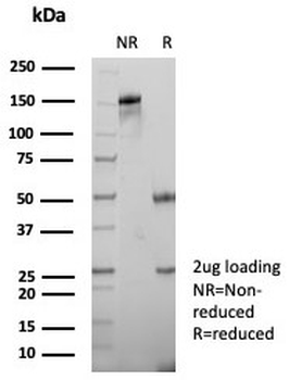 CD185 Antibody / CXCR5 / BLR1 / MDR15
