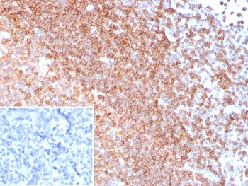 CD185 Antibody / CXCR5 / BLR1 / MDR15