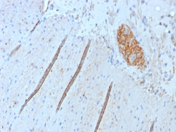 Recombinant CD56 Antibody