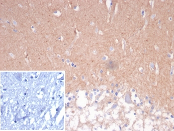 CD56 Antibody