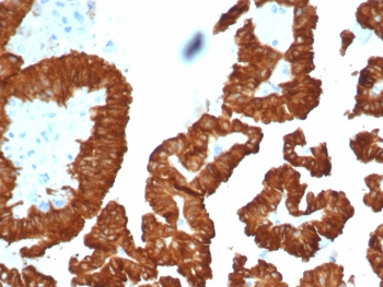 Crystallin Alpha B Antibody