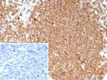 Recombinant CD20 Antibody