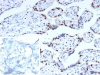 p57Kip2 Antibody