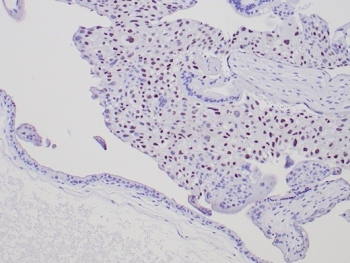 p57Kip2 Antibody