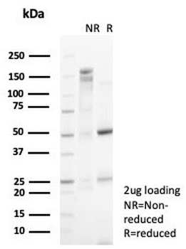 p57Kip2 Antibody