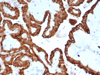 Crystallin Alpha B Antibody