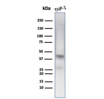 Wilms Tumor 1 Antibody / WT1