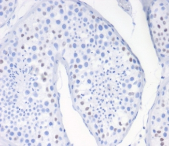 Wilms Tumor 1 Antibody / WT1