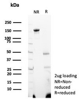 Wilms Tumor 1 Antibody / WT1
