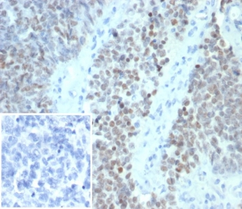 Wilms Tumor 1 Antibody / WT1