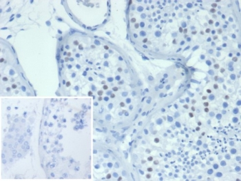Wilms Tumor 1 Antibody / WT1