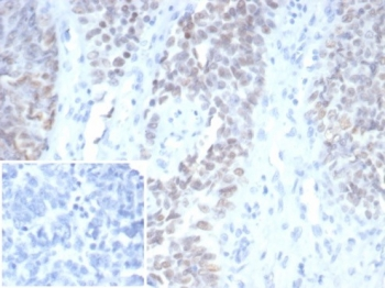 Wilms Tumor 1 Antibody / WT1