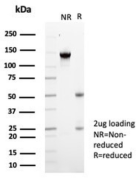 KCNIP2 Antibody / KChIP2