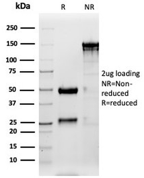 Pulmonary Surfactant-Associated Protein D Antibody