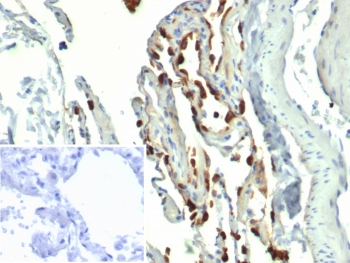 Pulmonary Surfactant-Associated Protein D Antibody