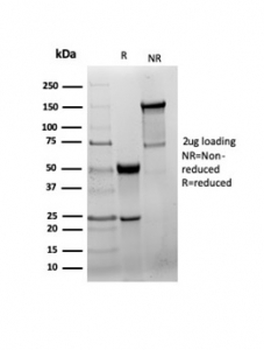 GAD65 Antibody / GAD2