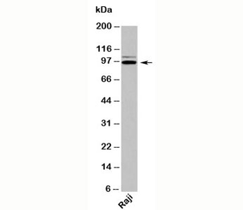 TRIL Antibody / KIAA0644