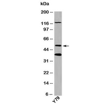 TXNIP Antibody