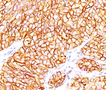 CAIX Antibody / Carbonic Anhydrase IX