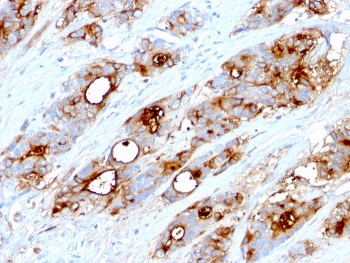 CEA Antibody / CEACAM5