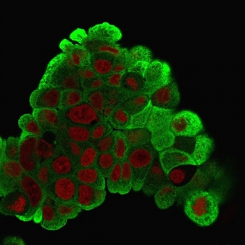 HSP27 Antibody
