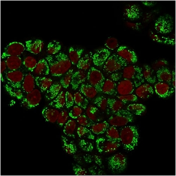 HSP60 Antibody / HSPD1