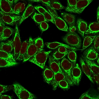 Cytokeratin 8 Antibody Cocktail