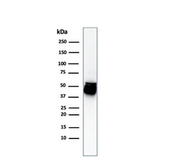 Cytokeratin 8 Antibody Cocktail