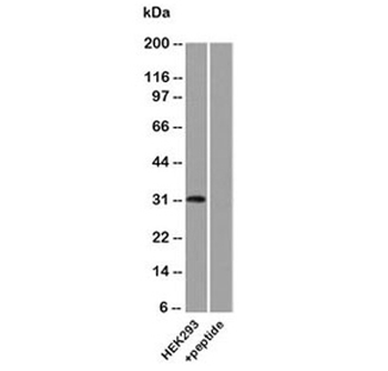 Uroplakin 3A Antibody