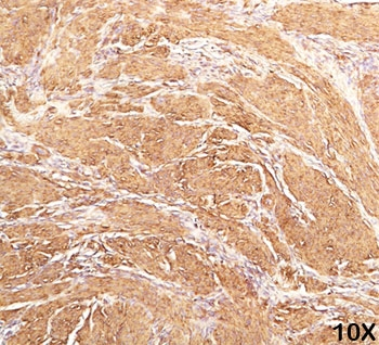 Muscle Actin Antibody (pan)