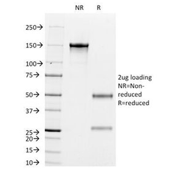 Cytokeratin 8/18 Antibody Cocktail