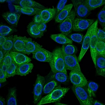 Multi Cytokeratin Antibody 4/5/6/8/10/13/18