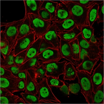 Human Nuclear Antigen Antibody