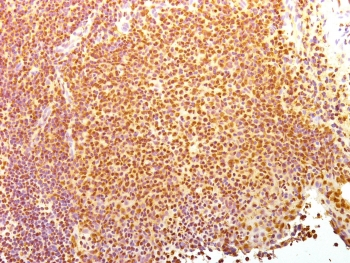 Human Nuclear Antigen Antibody